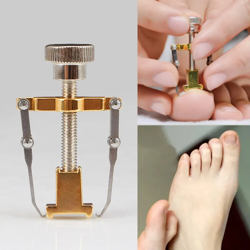 

Ingrown Toenail Corrector Stainless Steel Foot Nail Care Pedicure Tool Bunion Treatment Tool