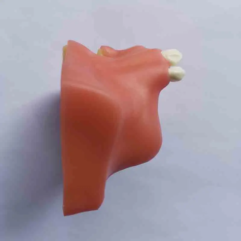 Смоляные максиллярные Зубы Модель верхняя челюсть синус Лифт имплантаты восстановление Стоматологическая практика модель для медицинского обучения