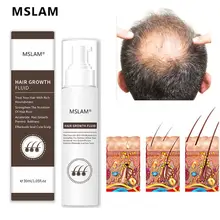 Hair Growth Spray 100% Natural Extracts Liquid Hair Regeneration Treatment Solutions Fast Growing Hair Oil Hair Loss Care 30ml