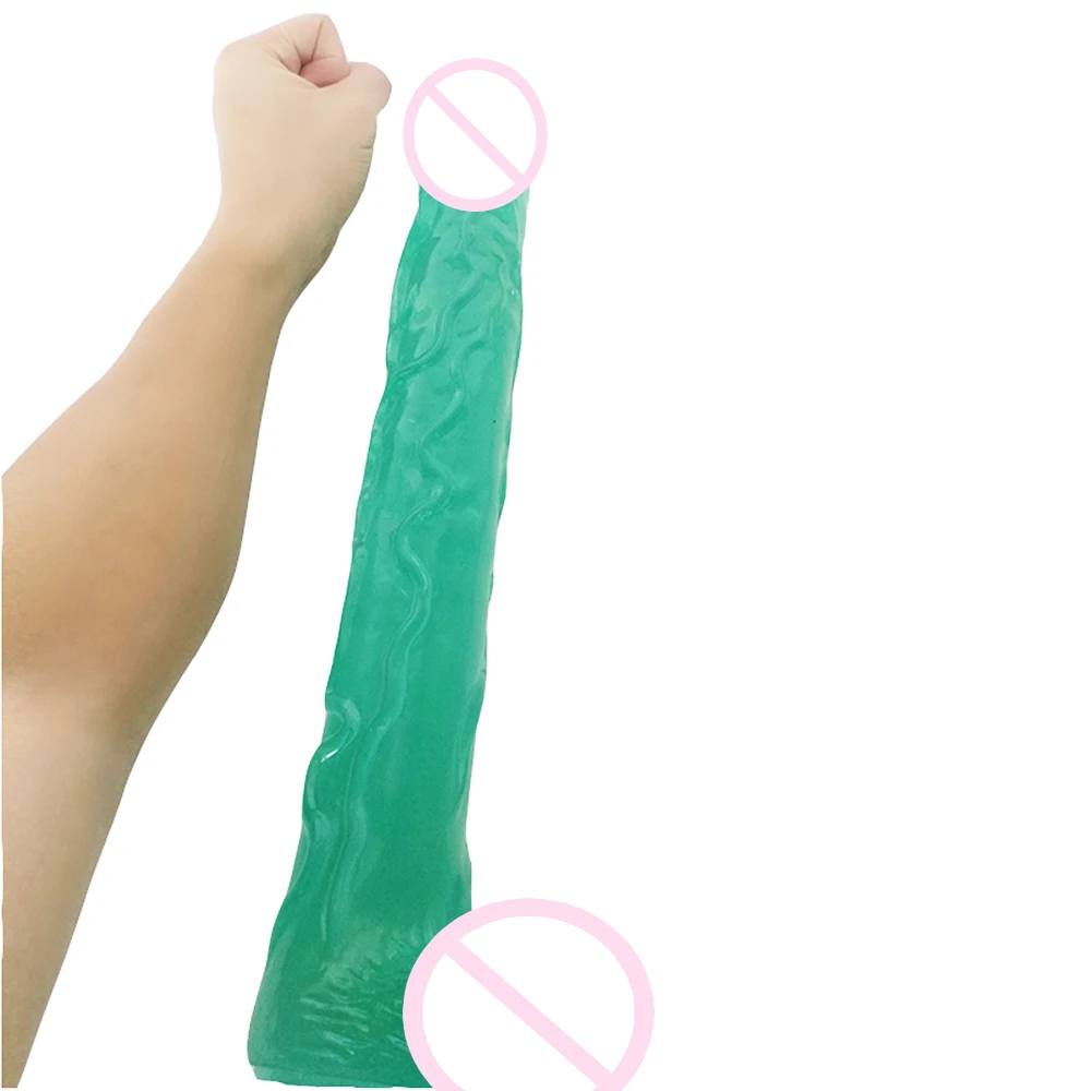 1 (4)
