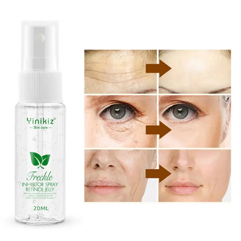 Freckle Removal Serum Moisturizing Lightening Pigment Brighten Skin Color Anti-aging Spray Bright White Pigment SkinCare