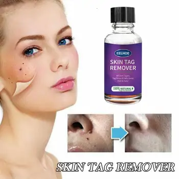 

Skin Tag Remover 10/20/30g Painless Skin Tag Removal Solution Mole Skin Dark Spot Removal Face Wart Tag Removal TSLM2