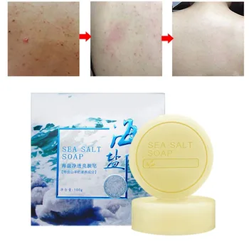 

New 1PC Sea Salt Soap whitening Moisturizing Wash Base Removal Pimple Pores Acne Treatment