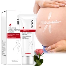 Удаление шрамов для беременных ремонт крем растяжки удаляет лечение Материнство против морщин и старения Winkles укрепляющие кремы для тела