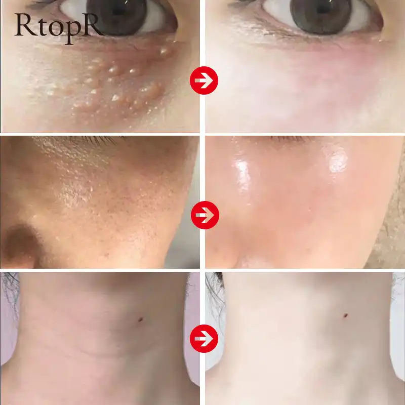 Rtopr マンゴー引き締めスキンに潤いアンチエイジング首クリーム毛穴収縮改善くすみオリーブ Peptid クリームスキンケアセット 顔用セルフタナー ブロンザー Aliexpress