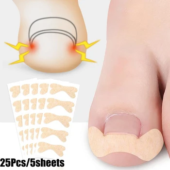 

Ingrown Toenail Correction Stickers Tool Toenail Treatment Corrector Stickers Pedicure Foot Toe Thumb Nail Care Patch Sticker