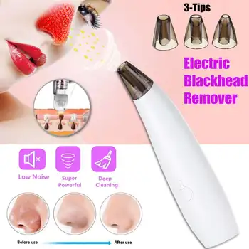 

Electric Blackhead Suction Remover Deep Cleaning Pores Dead Skin Cells Removal Machine with 3 Replaceable Tips Facial Care Tools