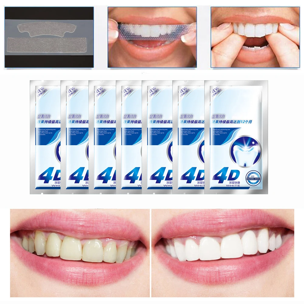 

Teeth Whitening Strips 3D Dental Veneers One Week Remove Stains Fast Result and No Sensitivity 7pcs/box Dental Bleaching Kit