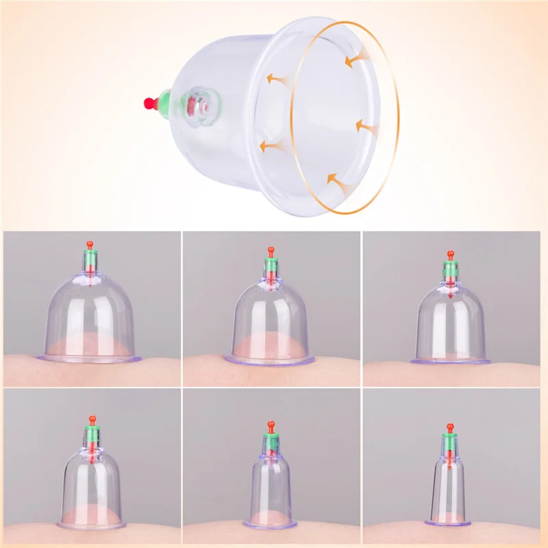 6 в 1 китайские терапевтические медицинские банки для терапии тела массаж набор медицинское изделие для акупунктуры Резиновые Вакуумные Банки снятие стресса всасывание для шеи тела