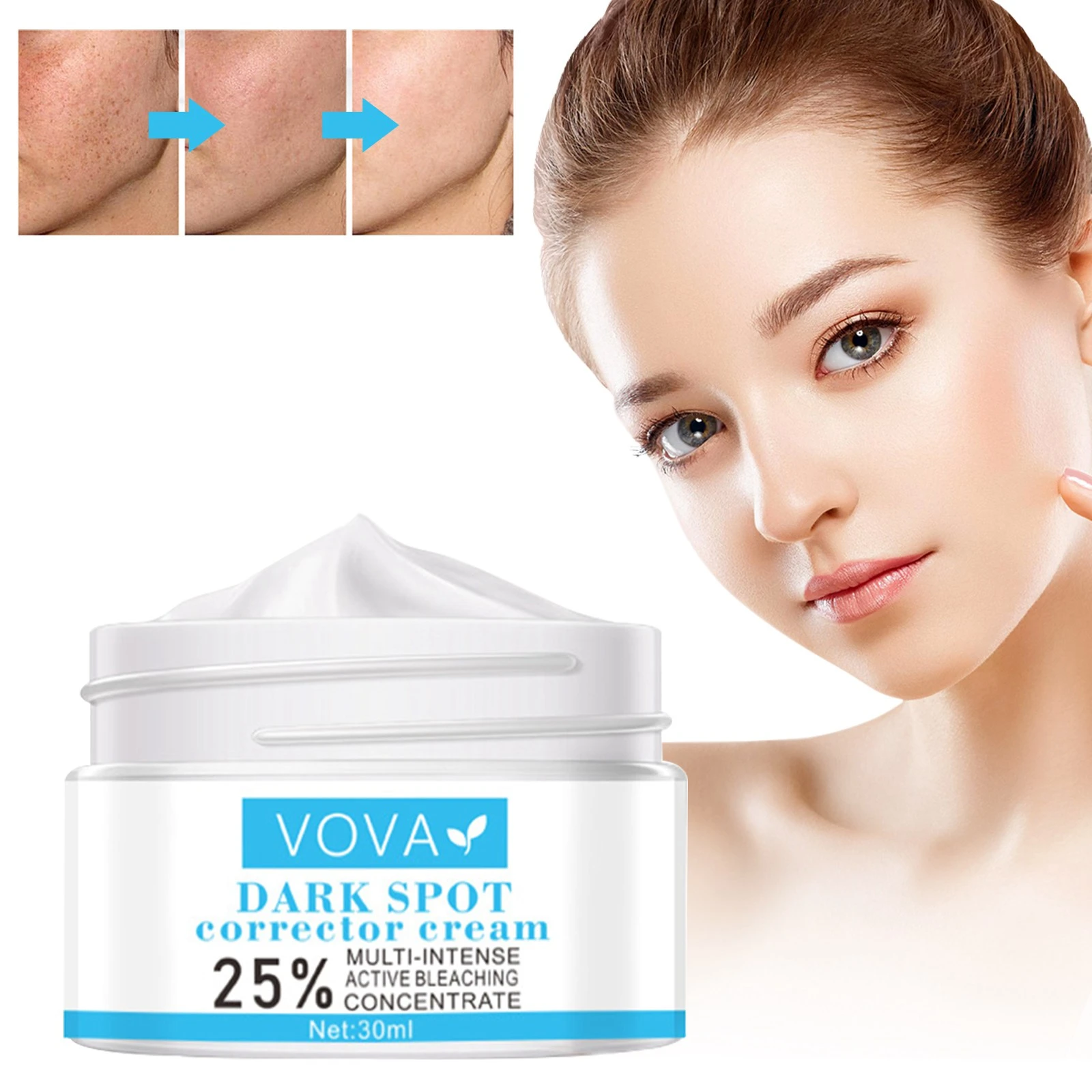 Vova 30g Dark Spot Removal Whitening Skin Cream Remove Melasma Acne
