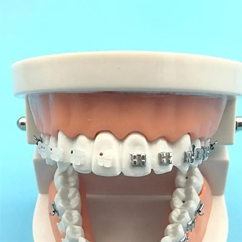 2 шт. стоматологический поднос черный коррекция полости рта керамический ортодонтический стоматологический кронштейн стоматологический поднос для больничных стоматологических зубов