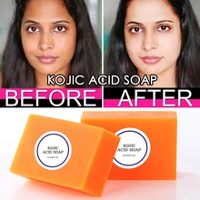 Skin-Lightening-Soap Glycerin Kojic-Acid Brighten Black Body-Skin Face Dark