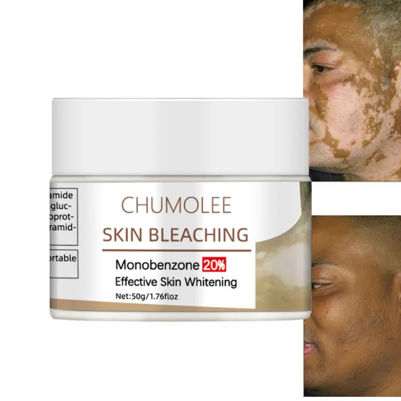 Отбеливающий крем для лица Chumolee Monobenzone отбеливание кожи виталиго уход за лицом