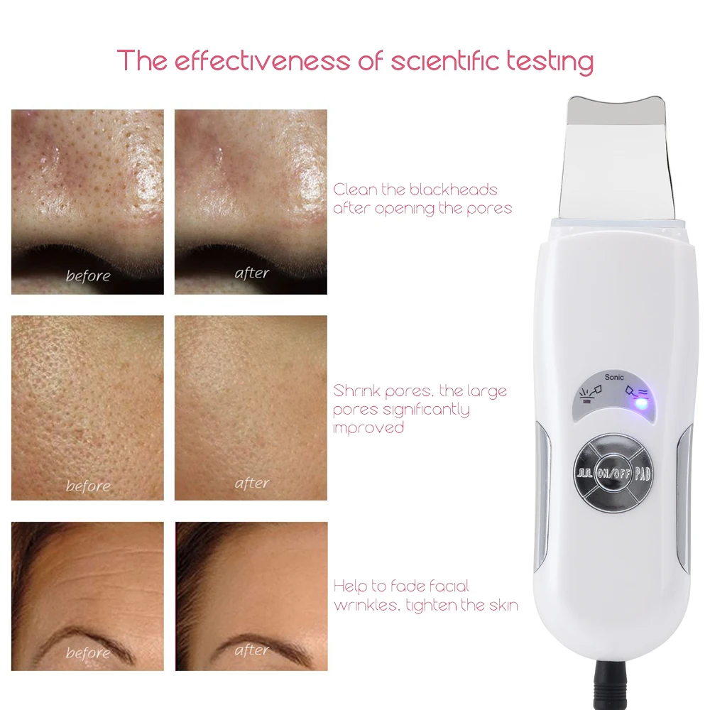 Home Use Ultrasonic Skin Scrubber Face Cleaner Deep Face Cleaning Pore Peeling Blackhead Removal Ultrasonic Skin Scrubber