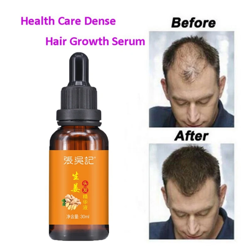 Женьшень решение для роста волос питает волосы, кожа головы анти-вилка лечебная процедура для восстановления роста волос продукт