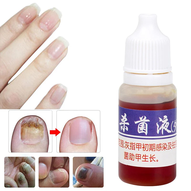 Серый дезинфицирующее средство для ногтей, жидкое средство для восстановления ногтей, натуральная эссенция, масло для удаления грибка пальцев ног для ухода за ногами TSLM2