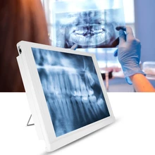 

AC110-220V Dental Film Viewer View Box LED Viewbox with Bracket Chip Clamp