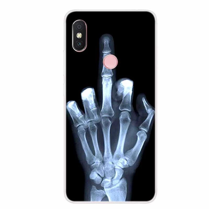 Luxury Silicone TPU Soft Phone Case Cover | Shockproof Cartoon Design