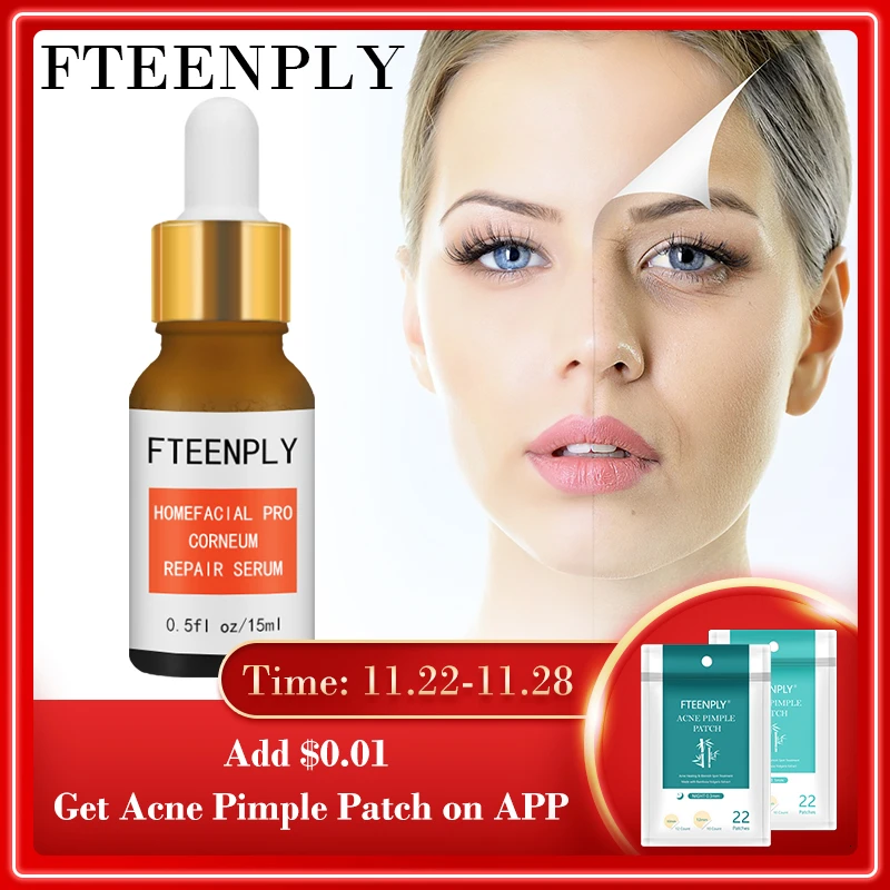 

FTEENPLY Nicotinamide Serum Facial Whitening Brightening Hyaluronic Acid Essence Moisturizing Anti-aging Shrink Pores Skin Care