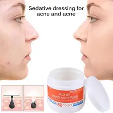 50 шт./кор. один шаг акне, прыщей, прозрачный ватным тампоном для пор, против акне инструмент для удаления пятен удаление Pad крем для лица Уход за кожей лечение акне колодки