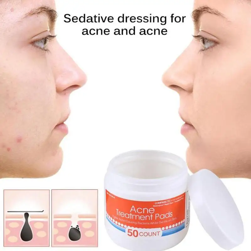 

50pcs/box One Step Acne Pimple Clear Cotton Pad Acne Pores Blemish Stain Remove Pad Facial Face Skin Care Acne Treatment Pads