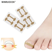 4 шт. патчи для вросшего ногтя, коррекция ногтей, восстановление ухода, патчи для пилочки, корректор для ног, педикюр