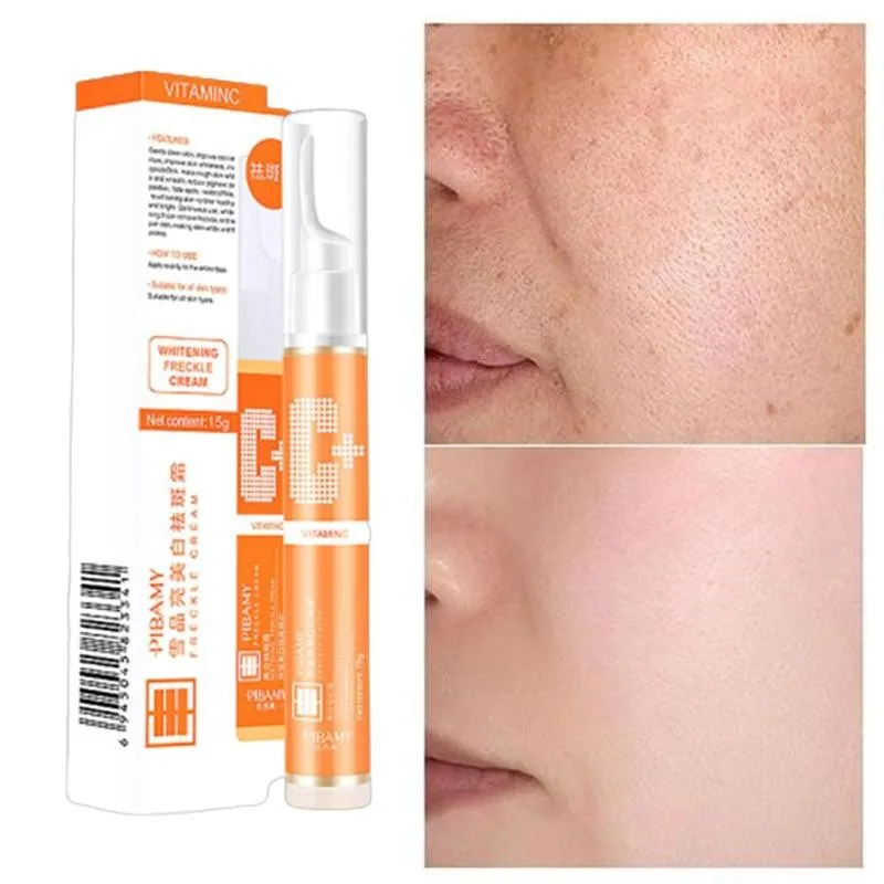 15ml Instant Blemish Removal Gel Vitamin C Whitening Anti Freckle Cream Pen Effective Remove the Freckle Pigmented Melanin Spots 15ml Instant Blemish Removal Gel Vitamin C Whitening Anti Freckle Cream Pen Effective Remove the Freckle Pigmented Melanin Spots