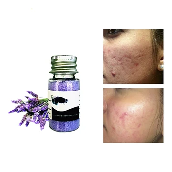

Rough Skin Exfoliator Beauty Salts Acne Essence Skin Whitening Pore Contraction Anti Wrinkle Lift Face Scar Repair Cream 25g
