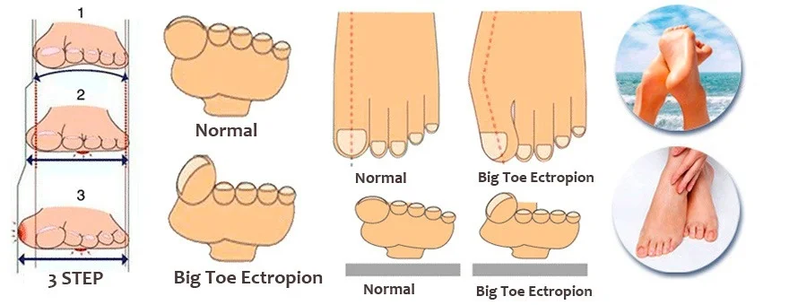 2PCS Silica Gel Toe Separator Stretchers Alignment Bunion Pain Relief Overlapping Massage Corrector science accessories