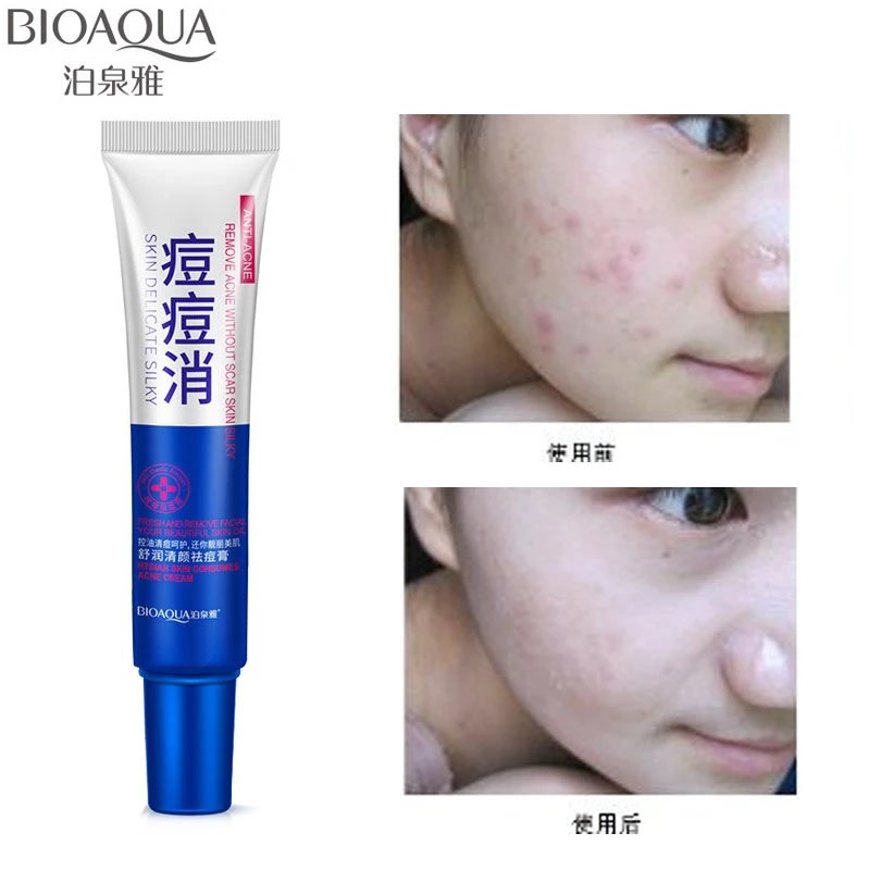 acne bioaqua