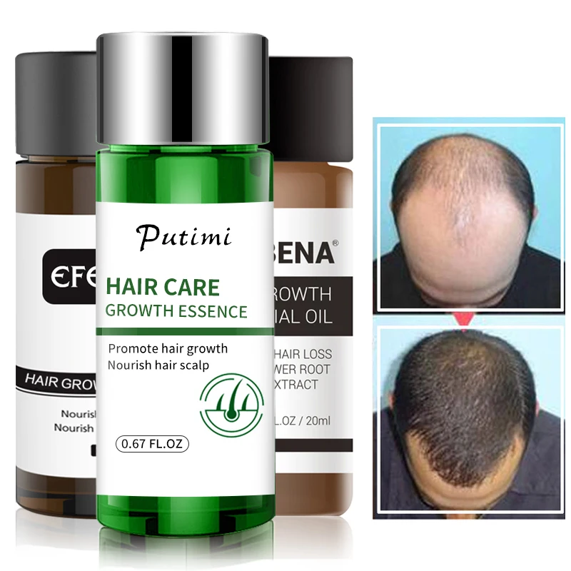 Serum Hair-Care-Products Anti-Hair-Loss-Treatment Preventing Baldness Fast 2pcs Dense
