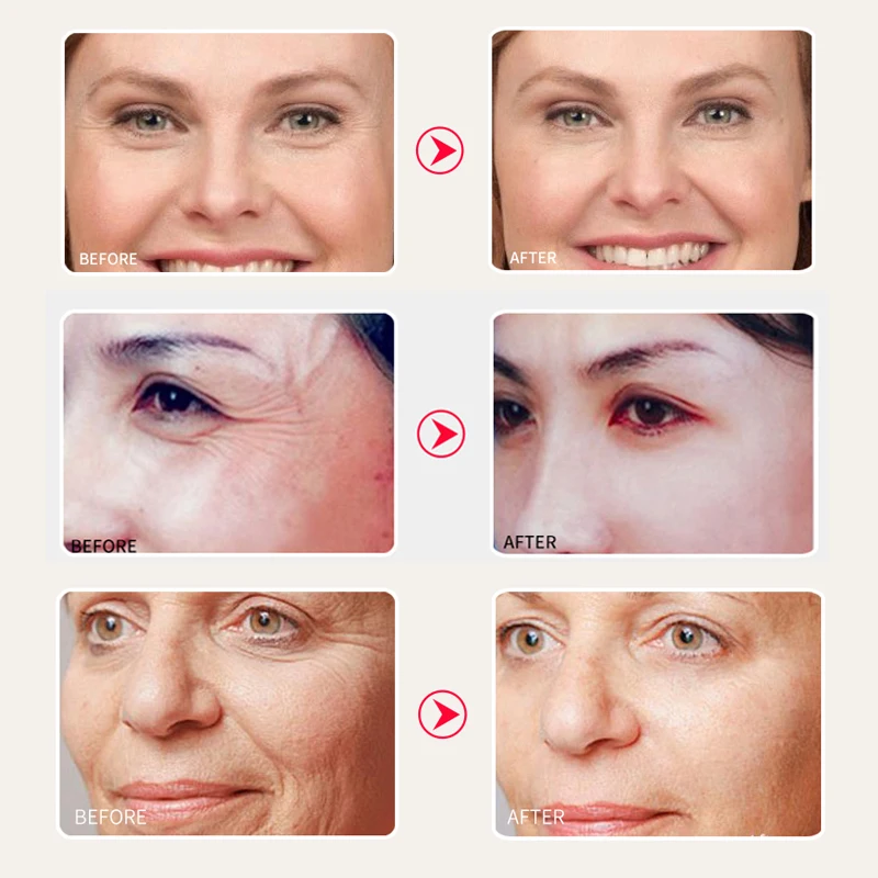 SOMILD Snail Face Cream Anti Aging Wrinkle Removal Cream Moisturizing Day Cream Korean Whitening Li