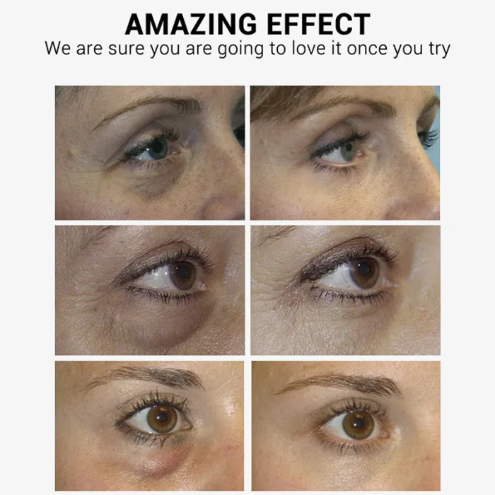 50pcs VC Eye Mask Reduces Dark Circles Soothing Firming Hardening Elevation Repair Serums HB88