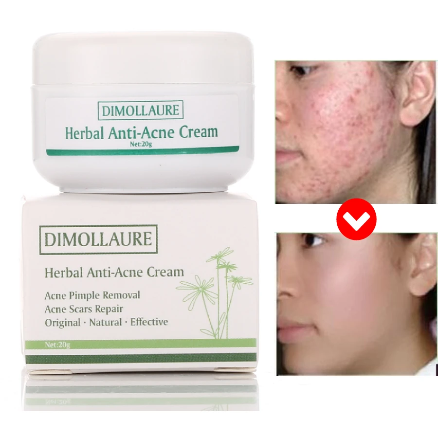 

Dimollaure Ginseng Acne Cleaning Cream herbal Skin Care Remove Repair Comedone Pimple Acne Face Acne Cream Anti Acne Treatment