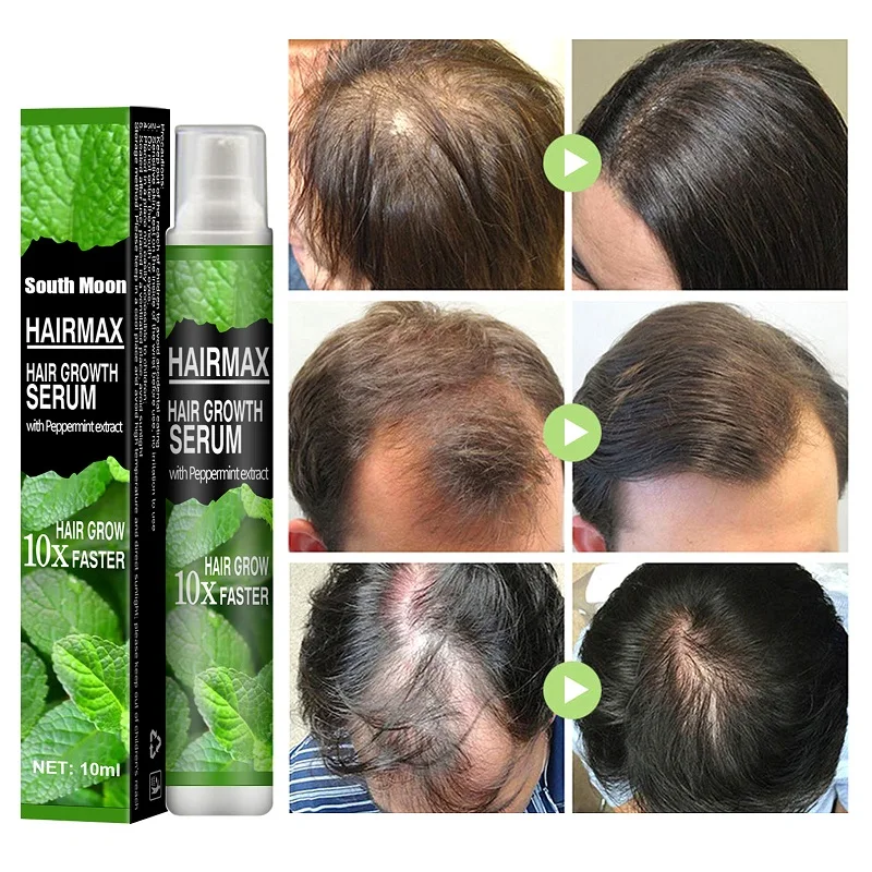 Hair Growth Spray Fast Grow Hair Oil Hair Loss Cure For Thinning Hair