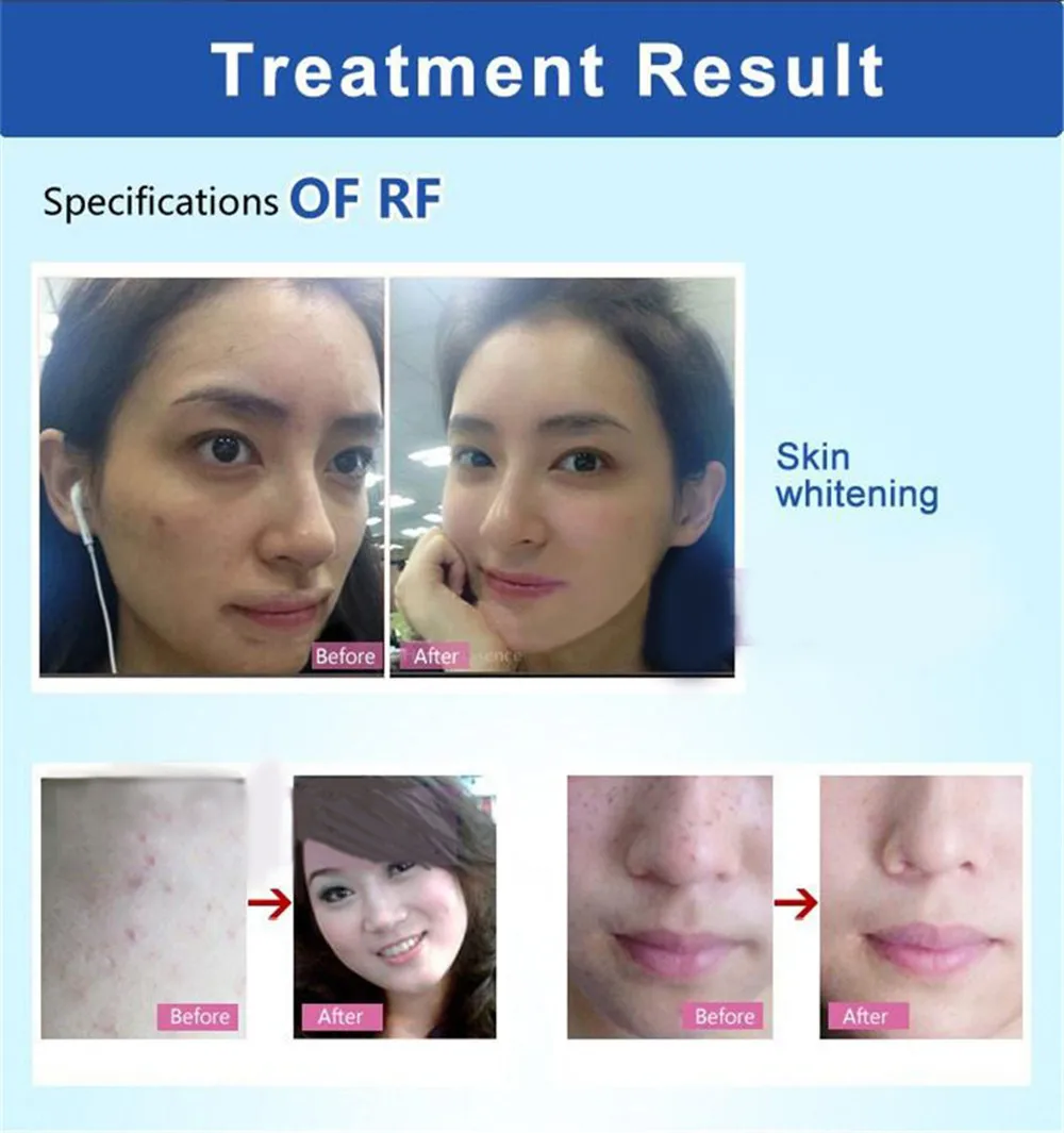 Skin Care Specialist Mesotherapy Machine Skin Tightening Lifting Wrink