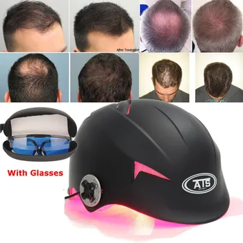 

128 Diodes Laser Cap Hair Loss Treatment Hair Regrowth Promoter Building Fibers Cap Therapy Stimulate Hair Follicle Regeneration