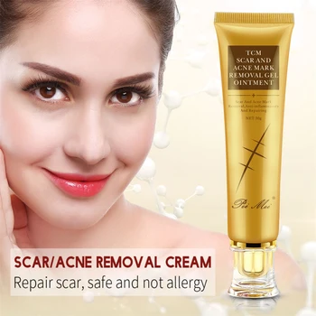 

30g Acne Scar Removal Cream Skin Repair Stretch Marks Remover Cream Acne Spots Acne Treatment Skin Care Whitening Moisturizing