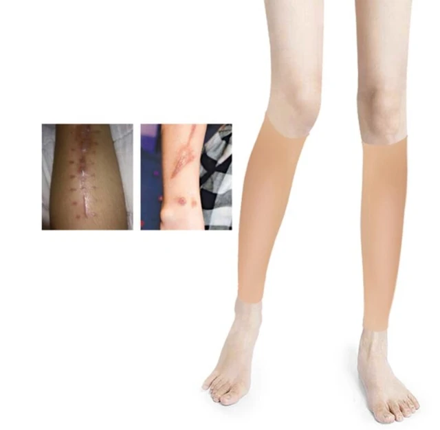 how-to-hide-scars-on-legs-in-summer-ppgbbe-intranet-biologia-ufrj-br