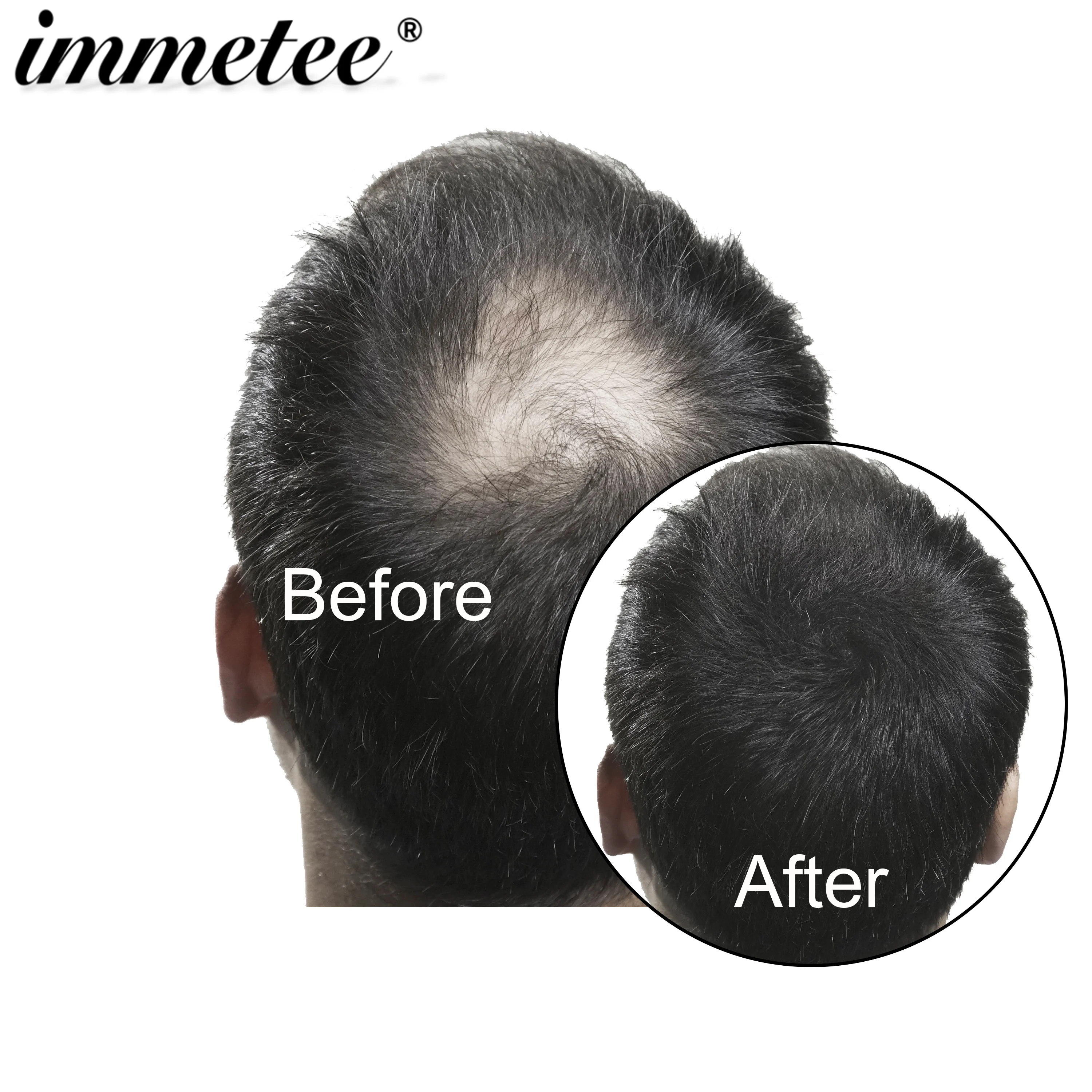 Пакеты для заправки волос 50 г = 25 * 2 шт.|hair fiber|hair loss treatmenthair |
