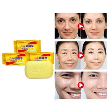 Экстракция растений китайское традиционное серное мыло для удаления угрей, очищающее кожу и акаридное очищающее мыло, отбеливающие продукты