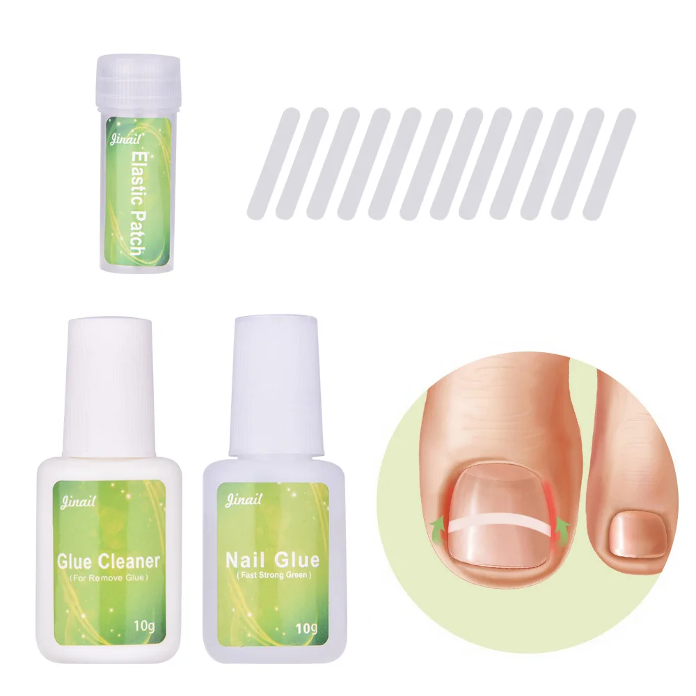 Ingrown Toenail Correction Tool Set Nail Pedicure Elastic Patch Straightening Clip Brace Bunion Corrector Patch Nail Stickers Ingrown Toenail Correction Tool Set Nail Pedicure Elastic Patch Straightening Clip Brace Bunion Corrector Patch Nail Stickers