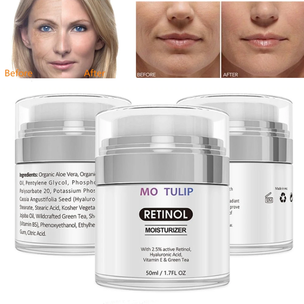 retinol and vitamin e cream
