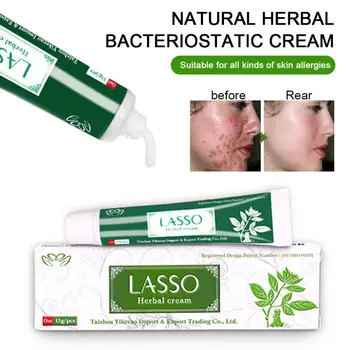 

YIGANERJING LASSO Acne Treatment Blackhead Anti Acne Cream Oil Control Shrink Pores Acne Scar Remove Face Care Whitening TSLM1