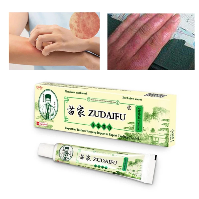 5pcs Dropshipping Zudaifu Skin Psoriasis Cream Dermatitis Eczematoid Eczema Ointment Treatment Psoriasis Cream Skin Care Cream