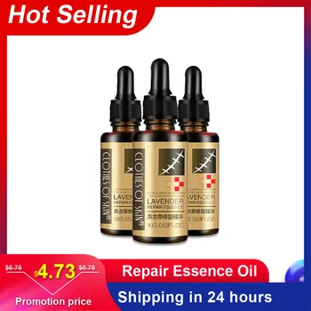 

Lavender Repair Essence Oil Dilute Remove Cream Acne Burn Scar Stretch Marks Removal Paste Skin Care Hyaluronic Acid Serum Oil