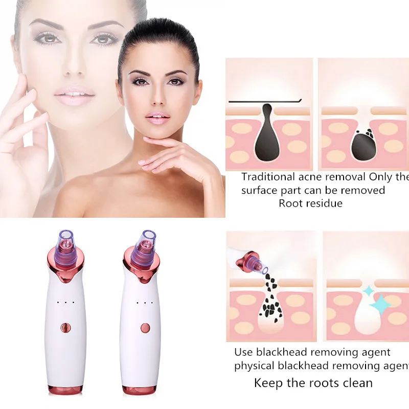 Electric-Blackhead-Remover-Point-Noir-Blackhead-Vacuum-Extractor-Tool-Black-Spots-Pore-Cleaner-Skin-Care-Beauty (1)