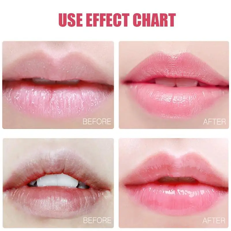 20Pcs Hydrating Moisturizing Lip Mask For Women Winter Lip Anti-drying Lightening Lip Lines Lip Care