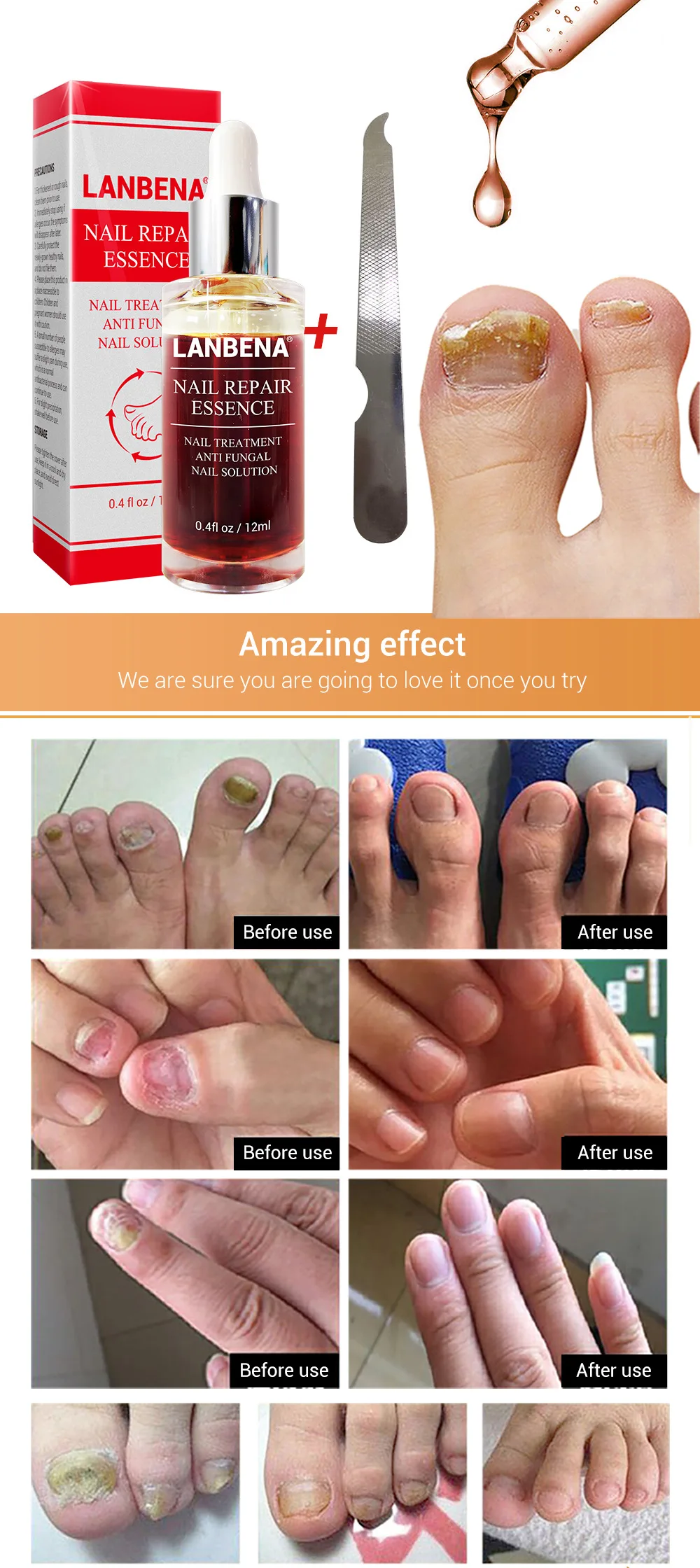 Уход восстановление грибка для ногтей жидкое лечение Onychomycosis Paronychia против удаления грибка для ногтей питательное осветление с напильником Nai