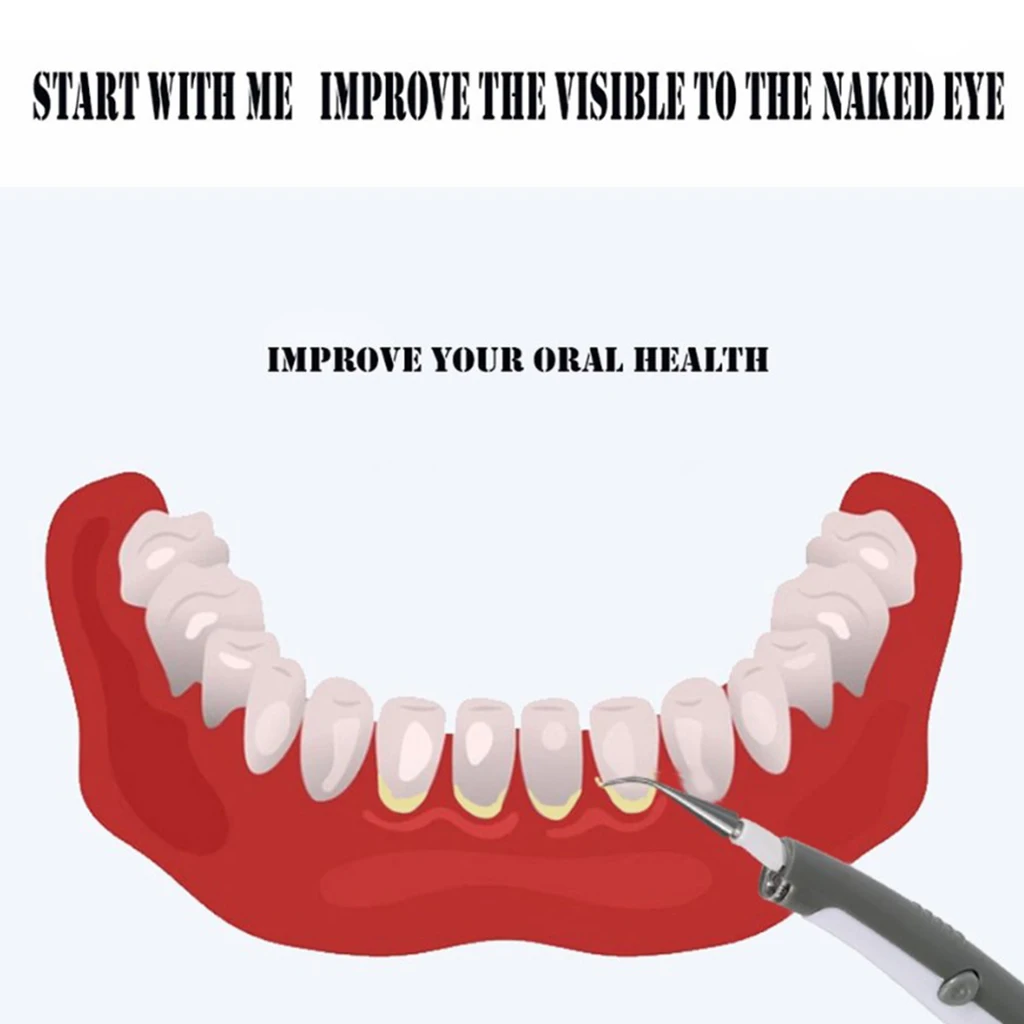 3x Electric Tooth Cleaner Stain Removal Scaler Tool Teeth Cleaning Oral Care 3x Electric Tooth Cleaner Stain Removal Scaler Tool Teeth Cleaning Oral Care